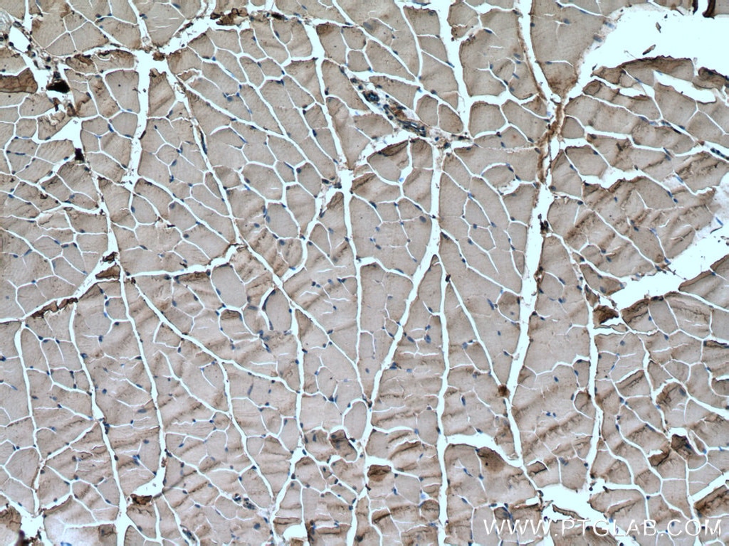 Immunohistochemistry (IHC) staining of mouse skeletal muscle tissue using Nav1.5 Polyclonal antibody (23016-1-AP)