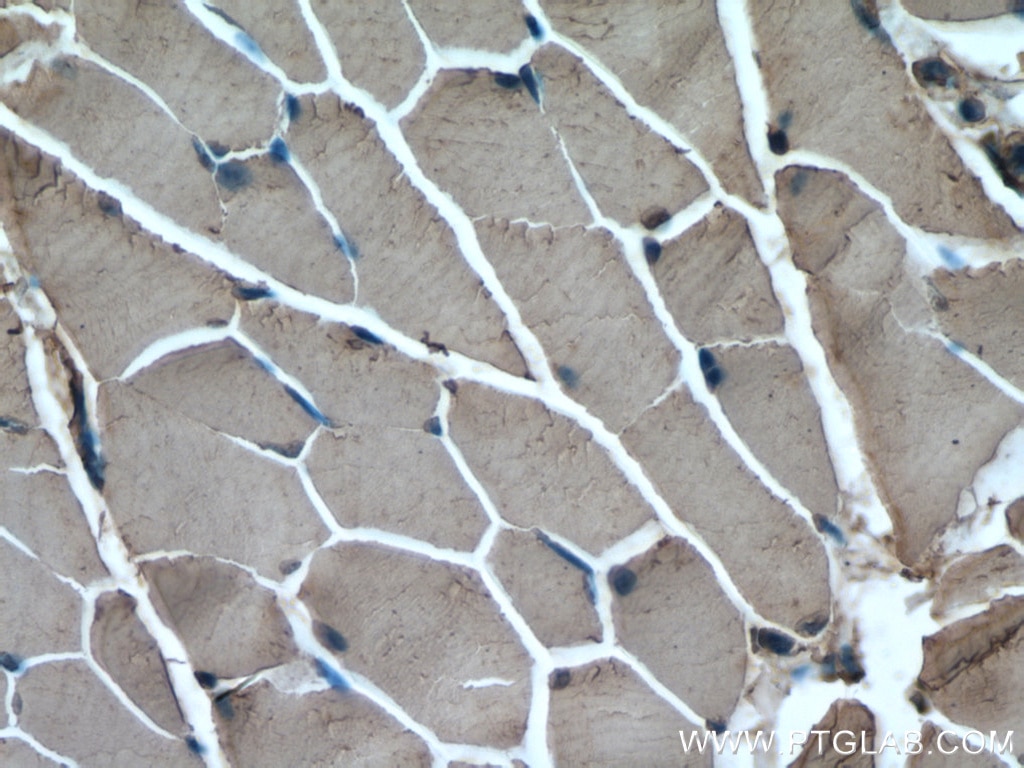 Immunohistochemistry (IHC) staining of mouse skeletal muscle tissue using Nav1.5 Polyclonal antibody (23016-1-AP)