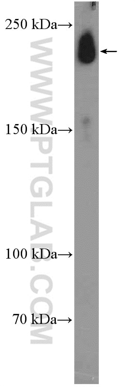 Western Blot (WB) analysis of mouse heart tissue using Nav1.5 Polyclonal antibody (23016-1-AP)