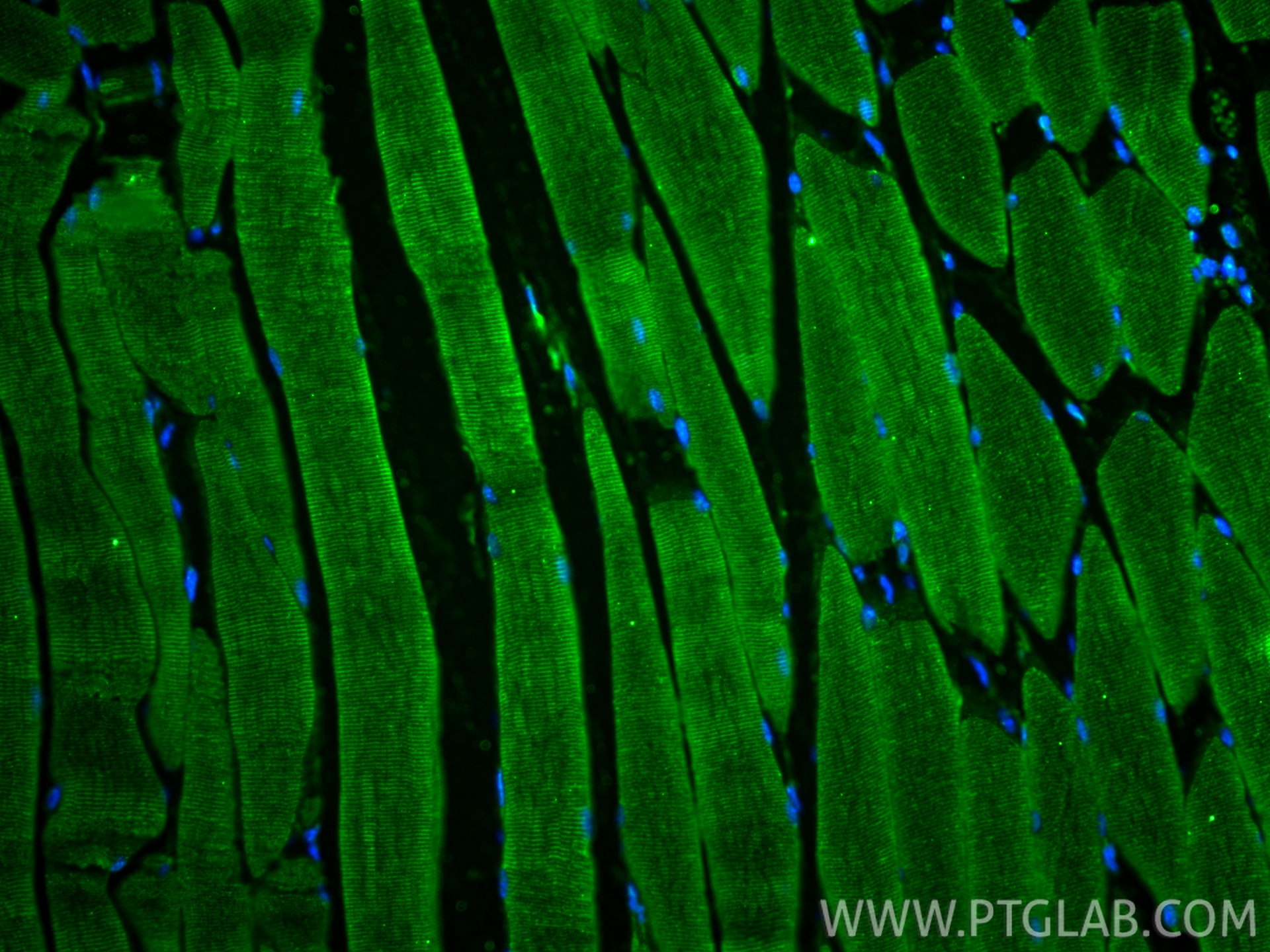 Immunofluorescence (IF) / fluorescent staining of mouse skeletal muscle tissue using SCN5A Monoclonal antibody (68273-1-Ig)