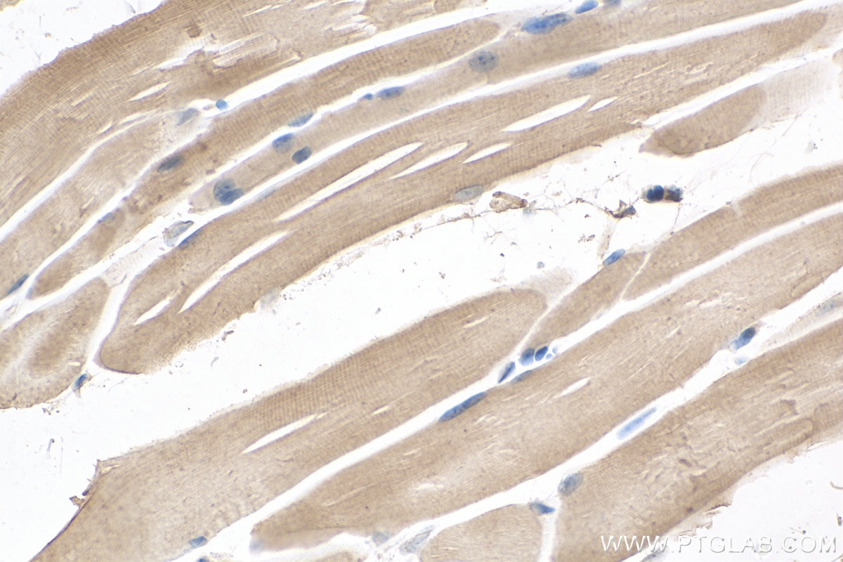 Immunohistochemistry (IHC) staining of mouse skeletal muscle tissue using SCN5A Monoclonal antibody (68273-1-Ig)