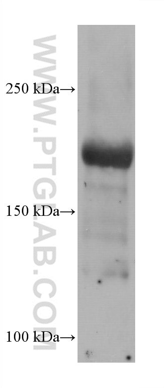 Western Blot (WB) analysis of rabbit heart tissue using SCN5A Monoclonal antibody (68273-1-Ig)