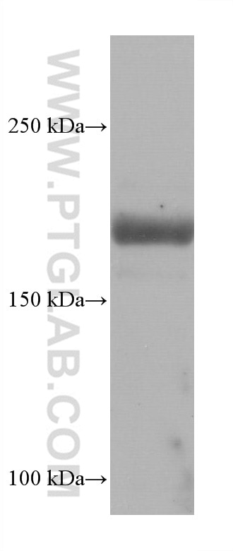 Western Blot (WB) analysis of rat heart tissue using SCN5A Monoclonal antibody (68273-1-Ig)