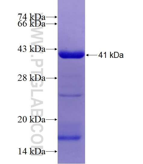 SCN5A fusion protein Ag19275 SDS-PAGE