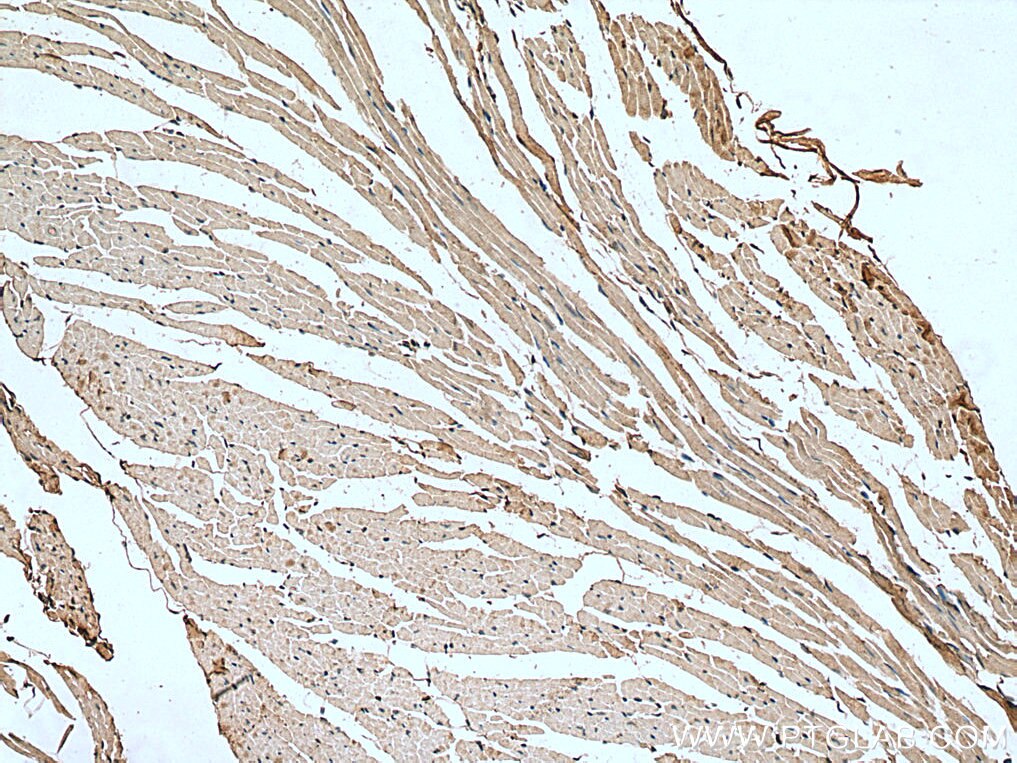 IHC staining of mouse heart using 20256-1-AP