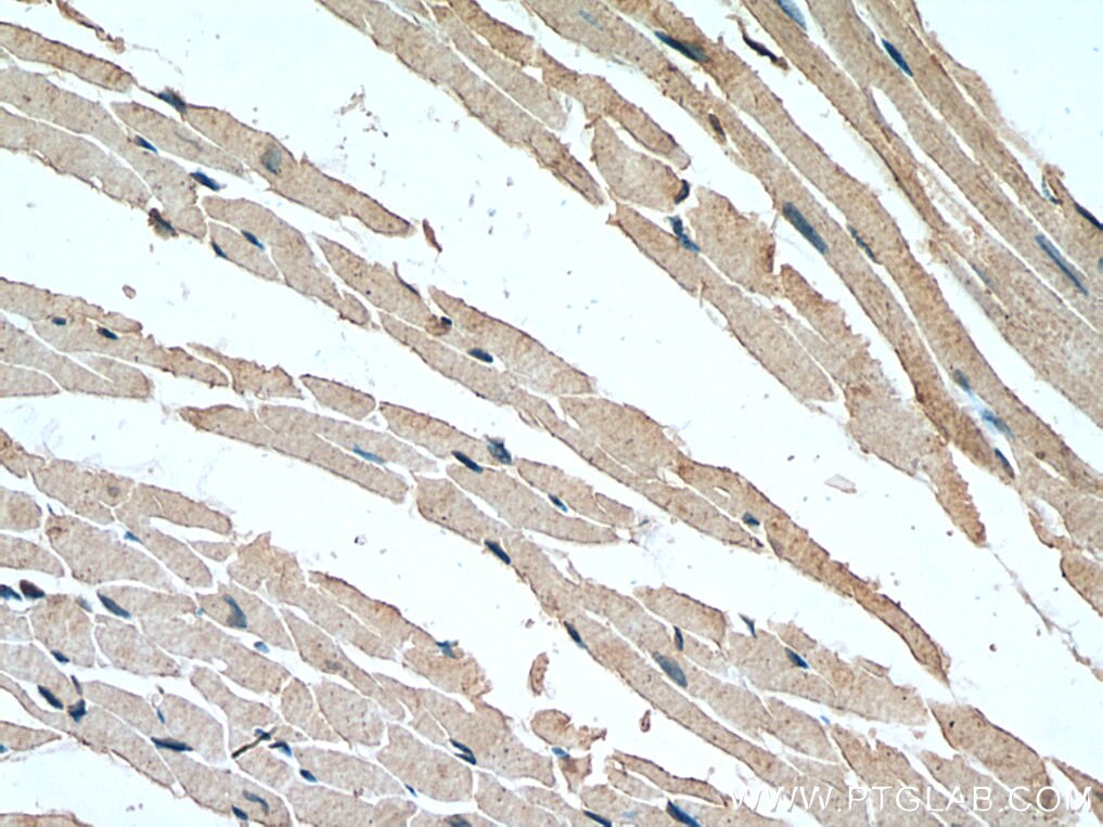 Immunohistochemistry (IHC) staining of mouse heart tissue using SCN7A-Specific Polyclonal antibody (20256-1-AP)