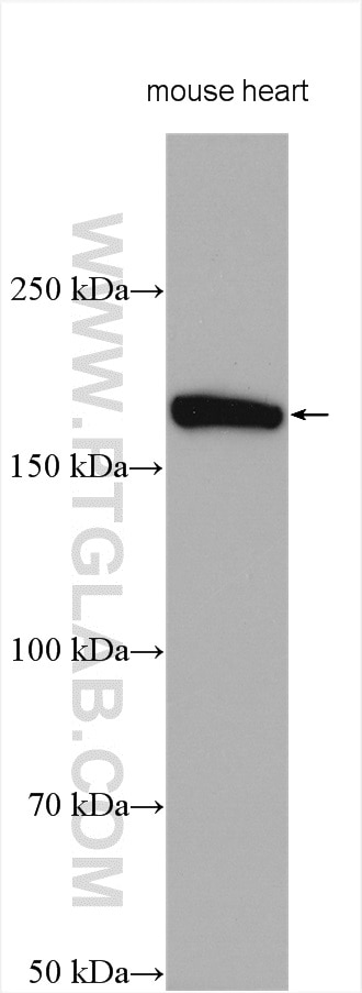 Western Blot (WB) analysis of various lysates using SCN7A-Specific Polyclonal antibody (20256-1-AP)