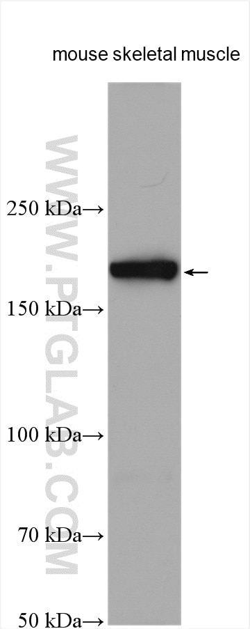 Western Blot (WB) analysis of various lysates using SCN7A-Specific Polyclonal antibody (20256-1-AP)