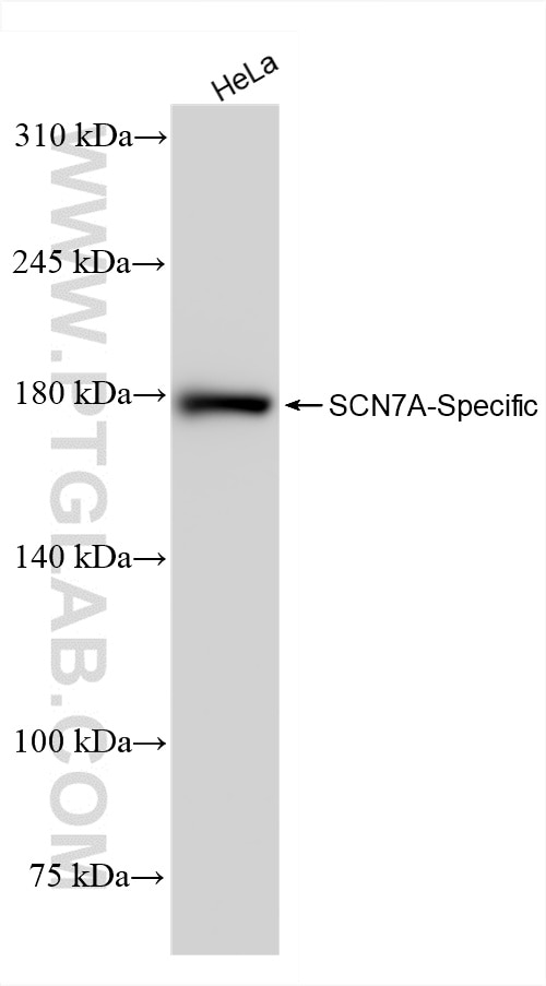Western Blot (WB) analysis of HeLa cells using SCN7A-Specific Recombinant antibody (85797-1-RR)