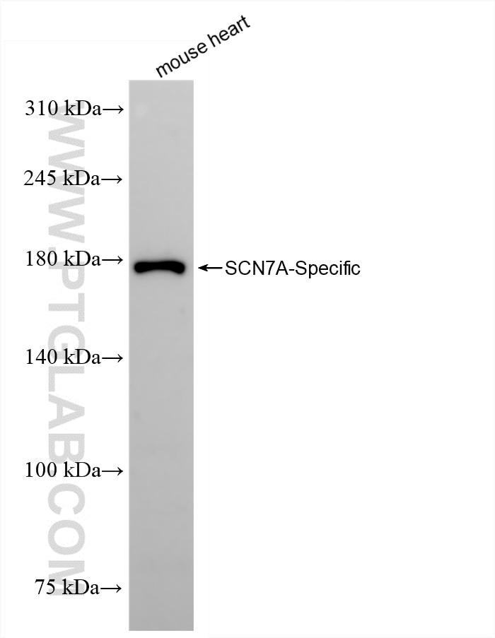 Western Blot (WB) analysis of mouse heart tissue using SCN7A-Specific Recombinant antibody (85797-1-RR)