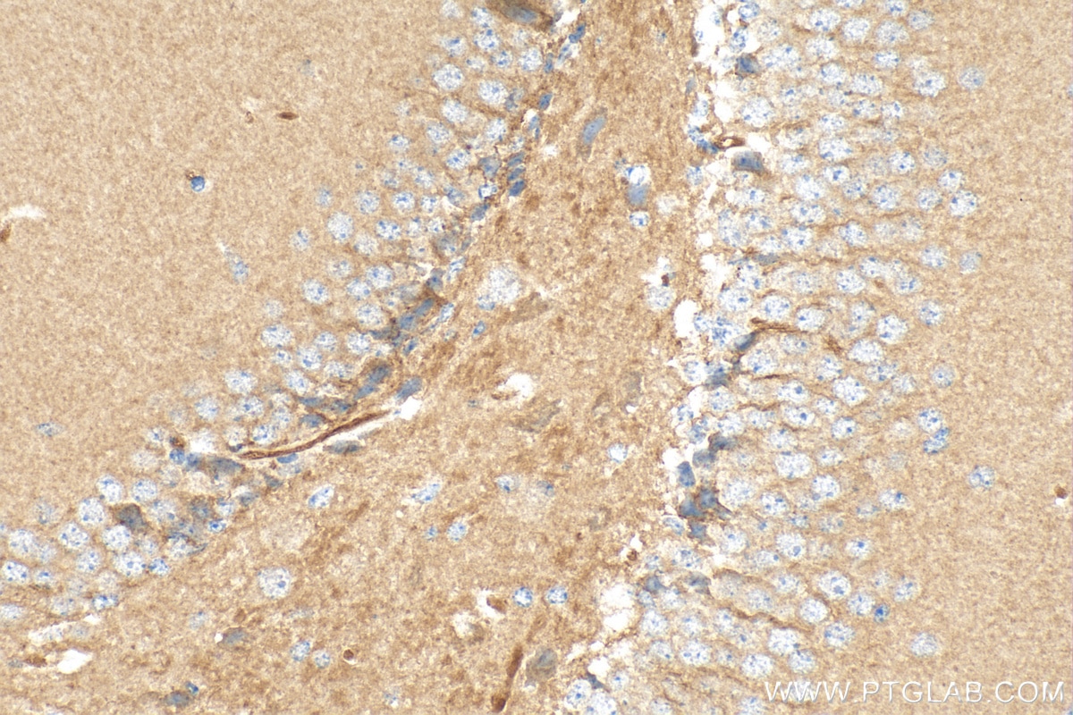 Immunohistochemistry (IHC) staining of mouse brain tissue using SCN8A Polyclonal antibody (28504-1-AP)