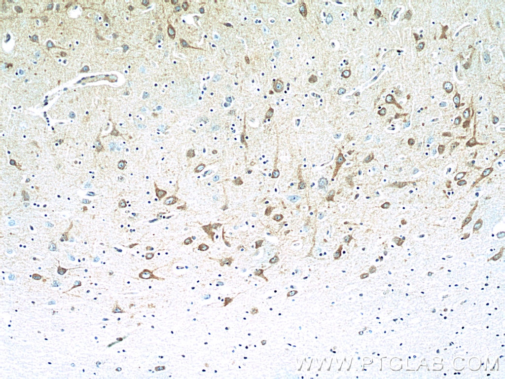 Immunohistochemistry (IHC) staining of human brain tissue using SCN9A/Nav1.7-Specific Polyclonal antibody (20257-1-AP)