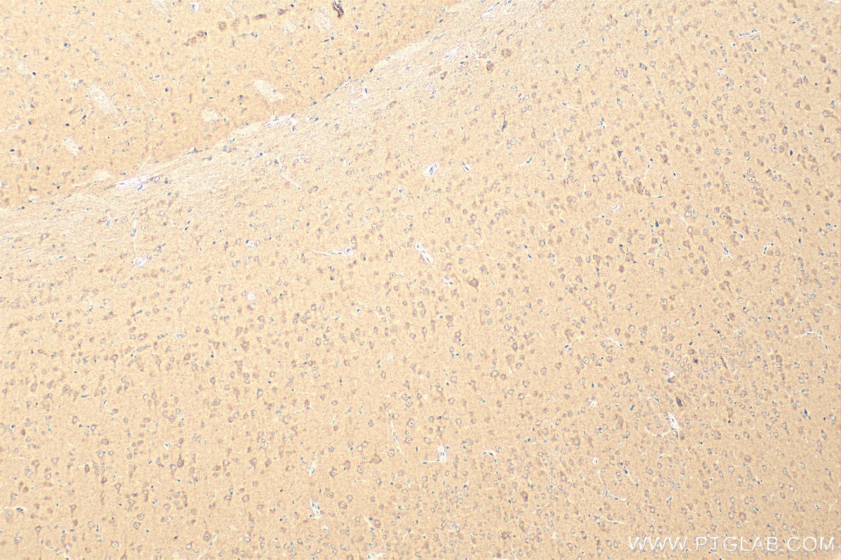 Immunohistochemistry (IHC) staining of mouse brain tissue using SCN9A/Nav1.7-Specific Polyclonal antibody (20257-1-AP)