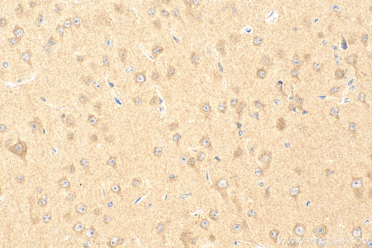 Immunohistochemistry (IHC) staining of mouse brain tissue using SCN9A/Nav1.7-Specific Polyclonal antibody (20257-1-AP)