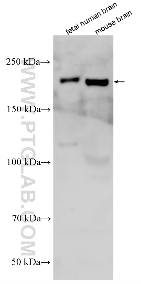 WB analysis using 20257-1-AP Western Blot (WB) analysis of various lysates using SCN9A/Nav1.7-Specific Polyclonal antibody (20257-1-AP)
