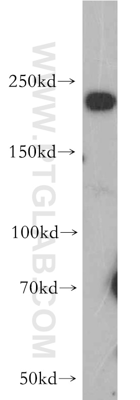 SCN9A/Nav1.7-Specific Polyclonal antibody