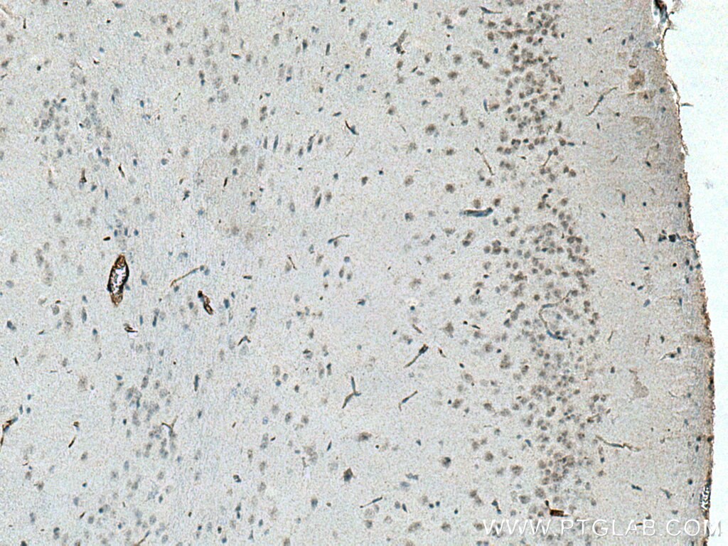 Immunohistochemistry (IHC) staining of mouse brain tissue using SCNM1 Polyclonal antibody (15490-1-AP)