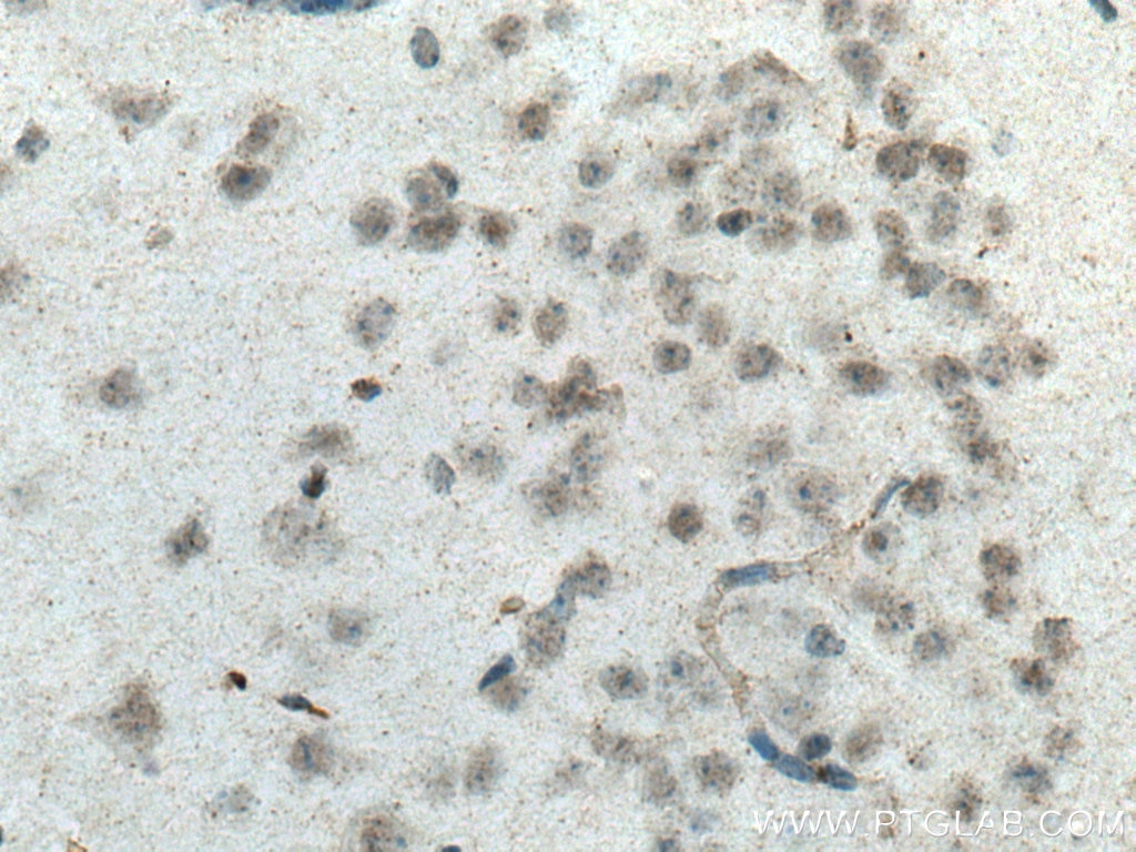 Immunohistochemistry (IHC) staining of mouse brain tissue using SCNM1 Polyclonal antibody (15490-1-AP)