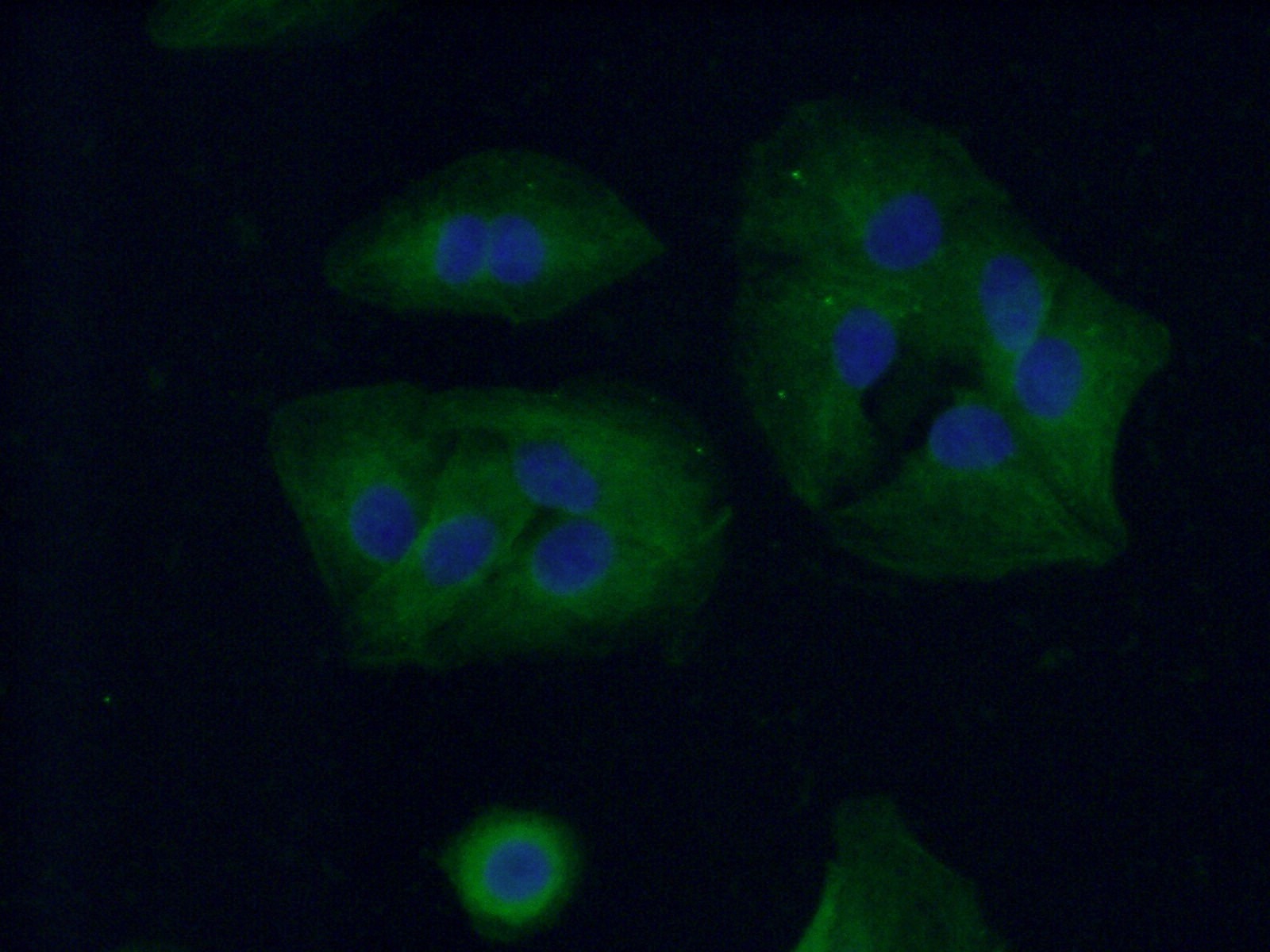 Immunofluorescence (IF) / fluorescent staining of A549 cells using SCNN1A Polyclonal antibody (10924-2-AP)