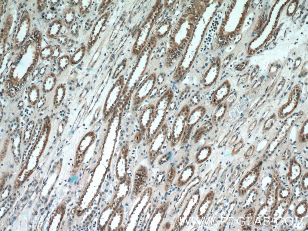 Immunohistochemistry (IHC) staining of human kidney tissue using SCNN1A Polyclonal antibody (10924-2-AP)