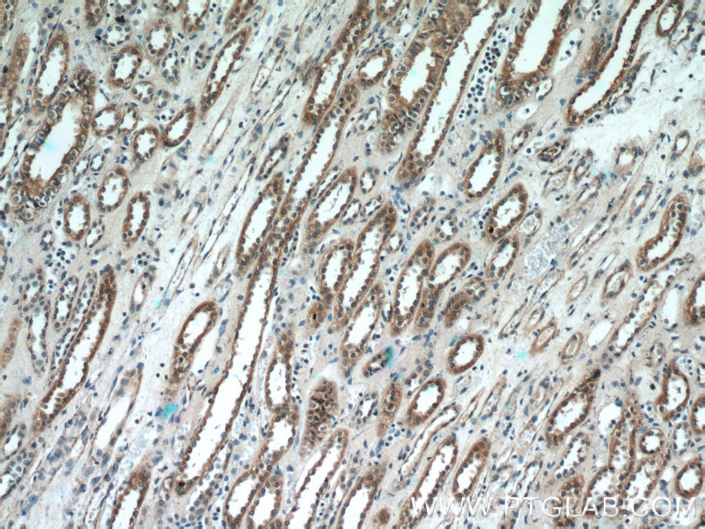 IHC staining of human kidney using 10924-2-AP