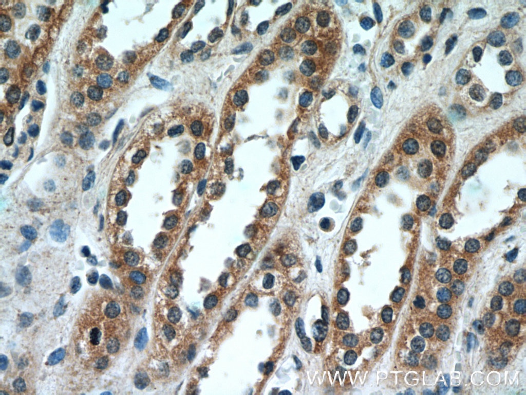 Immunohistochemistry (IHC) staining of human kidney tissue using SCNN1A Polyclonal antibody (10924-2-AP)