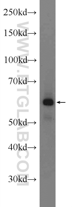 Western Blot (WB) analysis of A549 cells using SCNN1A Polyclonal antibody (10924-2-AP)