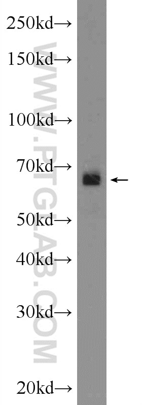 Western Blot (WB) analysis of PC-13 cells using SCNN1A Polyclonal antibody (10924-2-AP)