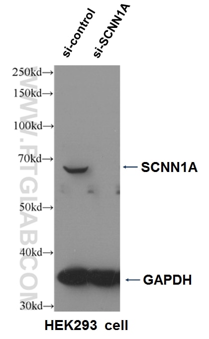 Western Blot (WB) analysis of HEK-293 cells using SCNN1A Polyclonal antibody (10924-2-AP)