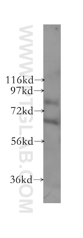 Western Blot (WB) analysis of human brain tissue using SCNN1A Polyclonal antibody (10924-2-AP)