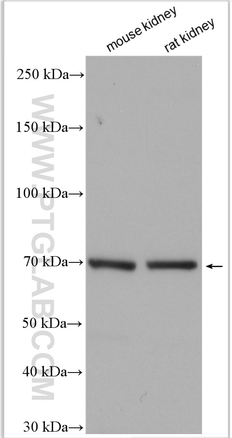 Western Blot (WB) analysis of various lysates using SCNN1A Polyclonal antibody (28707-1-AP)
