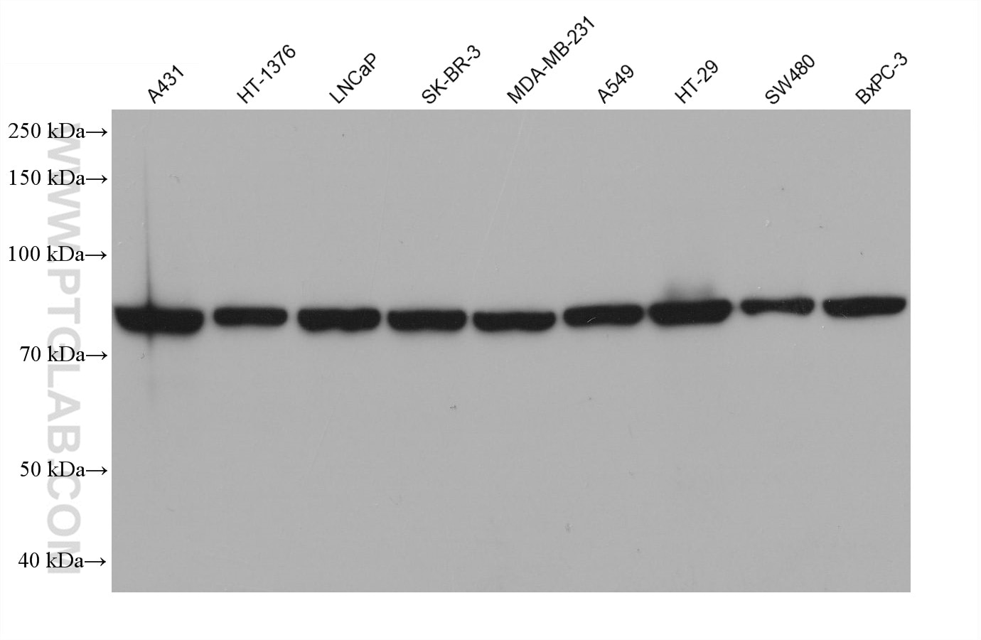 Western Blot (WB) analysis of various lysates using SCNN1A Monoclonal antibody (68581-1-Ig)