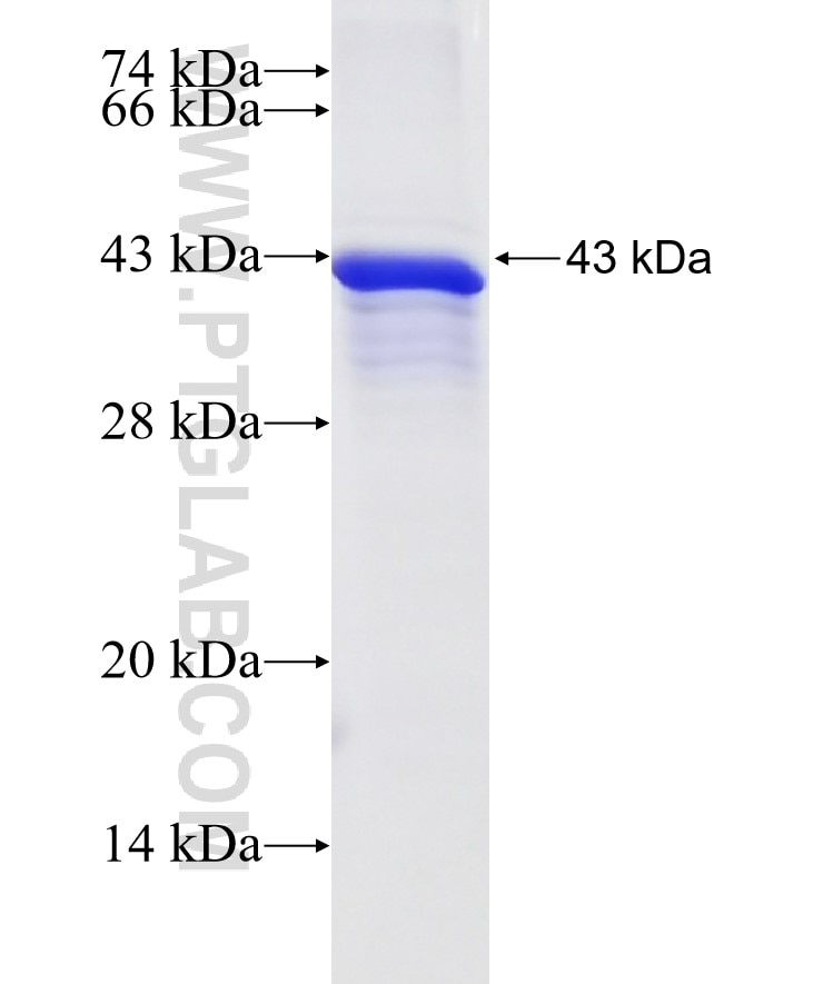 SCNN1A fusion protein Ag29548 SDS-PAGE