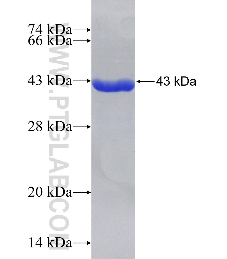 SCNN1A fusion protein Ag31586 SDS-PAGE