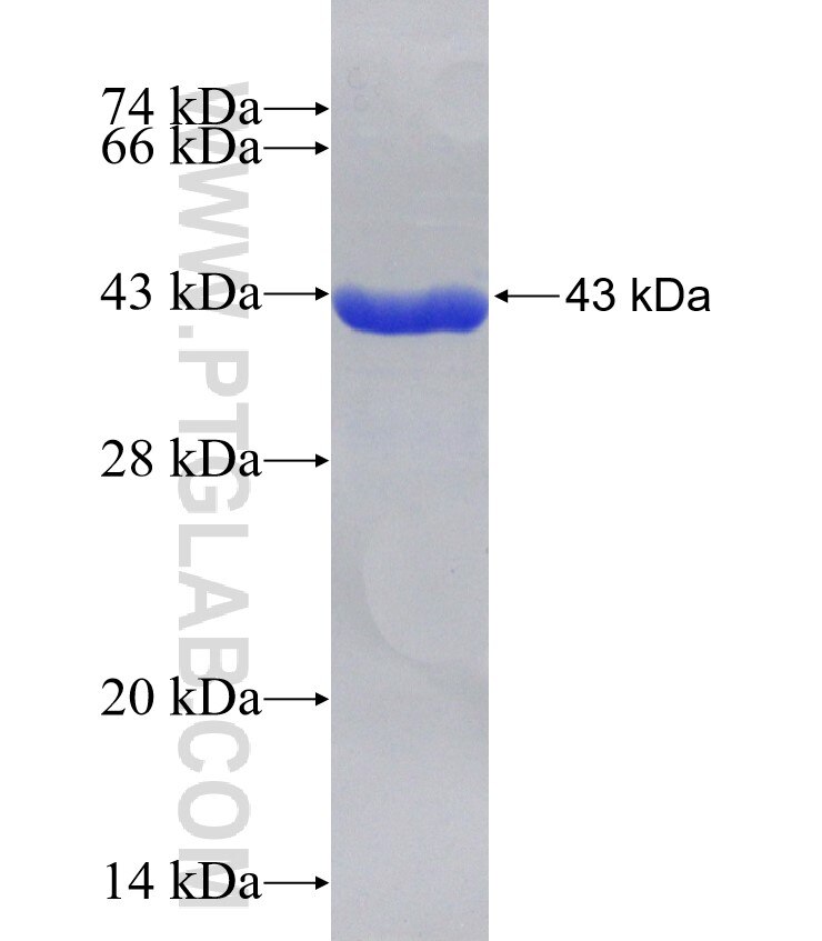 SCNN1A fusion protein Ag31586 SDS-PAGE