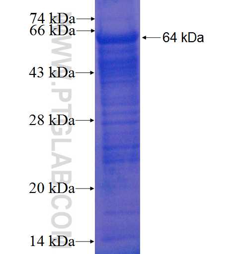 SCNN1A fusion protein Ag1325 SDS-PAGE