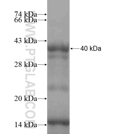 SCNN1D fusion protein Ag18671 SDS-PAGE
