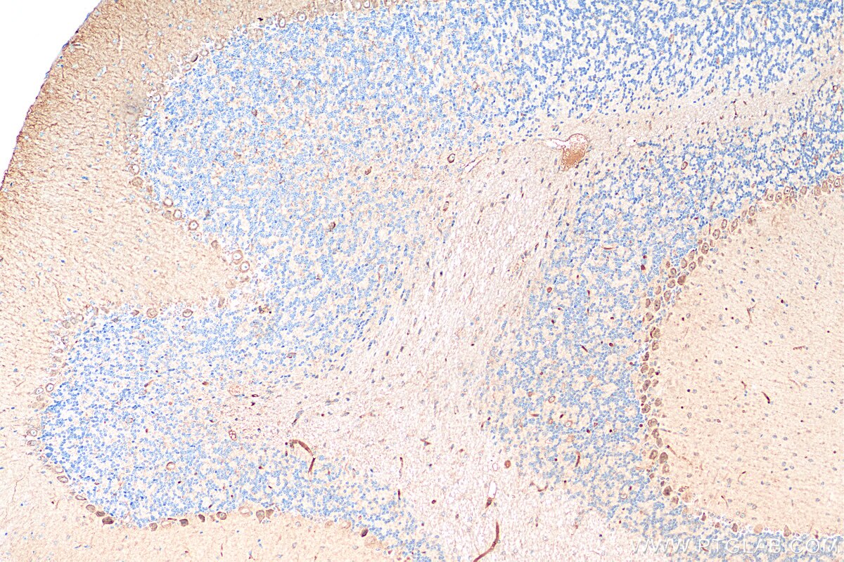 Immunohistochemistry (IHC) staining of mouse cerebellum tissue using SCNN1G Polyclonal antibody (13943-1-AP)