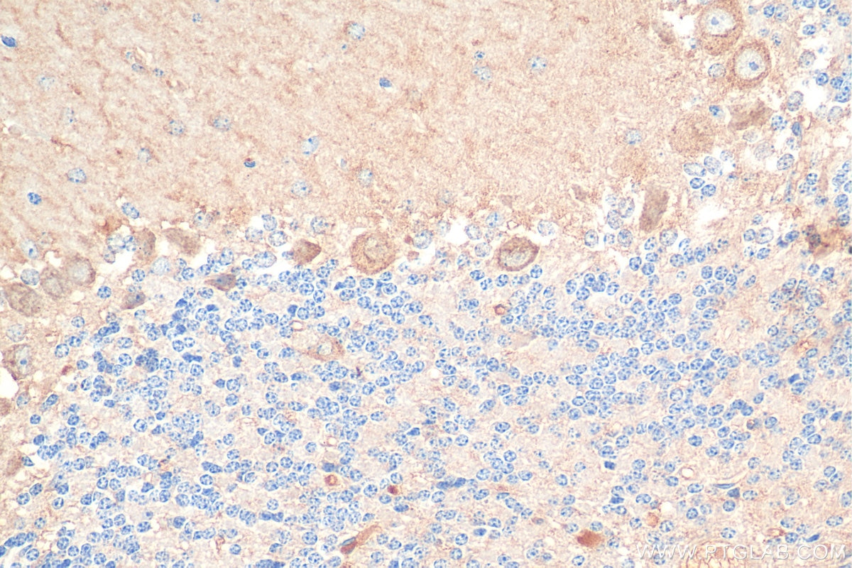 Immunohistochemistry (IHC) staining of mouse cerebellum tissue using SCNN1G Polyclonal antibody (13943-1-AP)