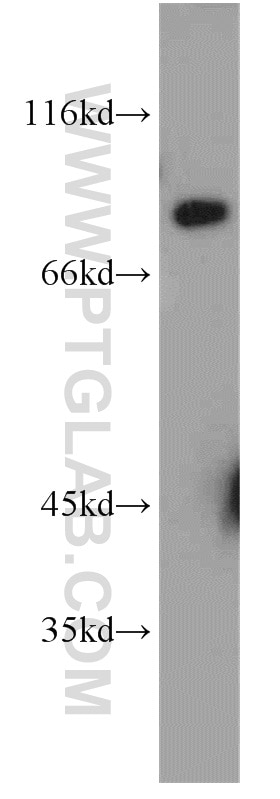 Western Blot (WB) analysis of mouse lung tissue using SCNN1G Polyclonal antibody (13943-1-AP)