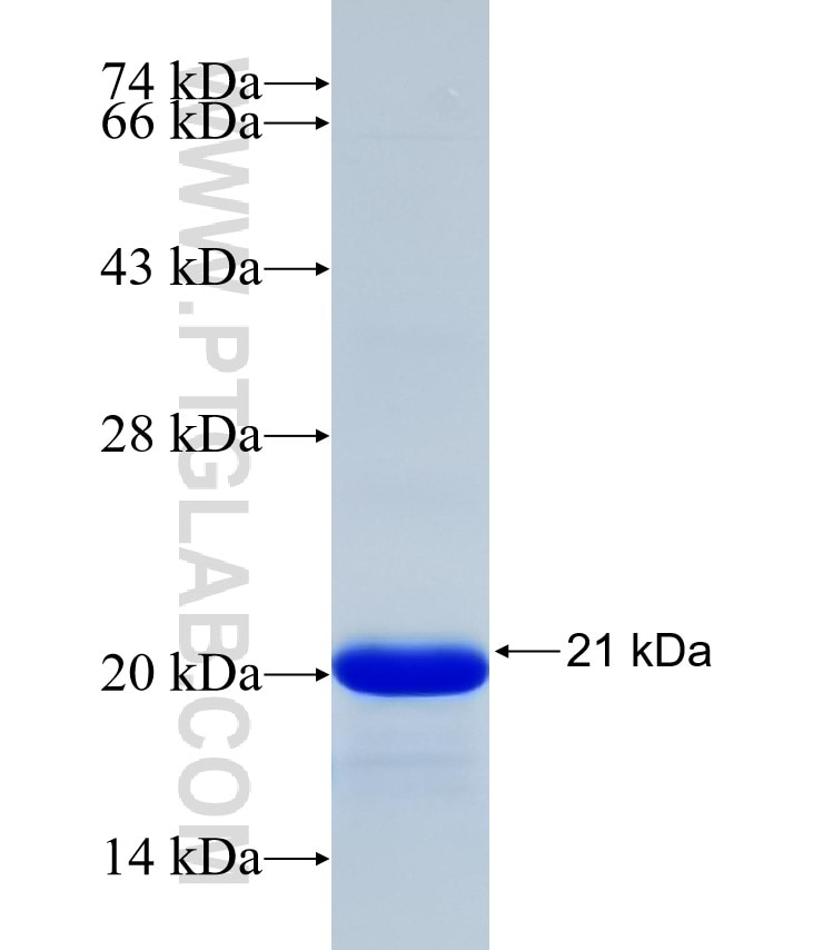 SCNN1G fusion protein Ag32182 SDS-PAGE