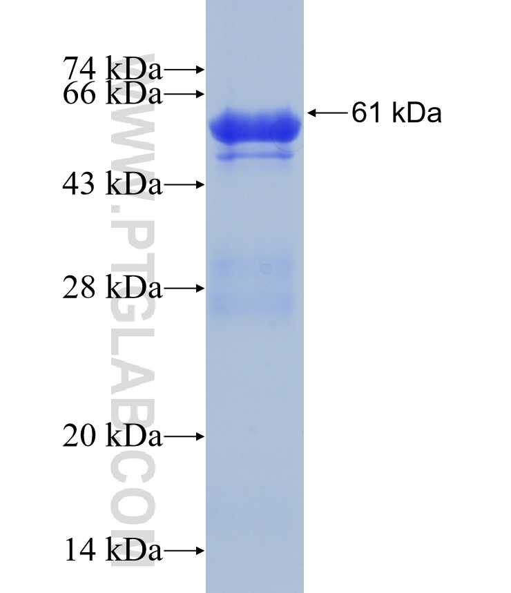 SCNN1G fusion protein Ag5020 SDS-PAGE
