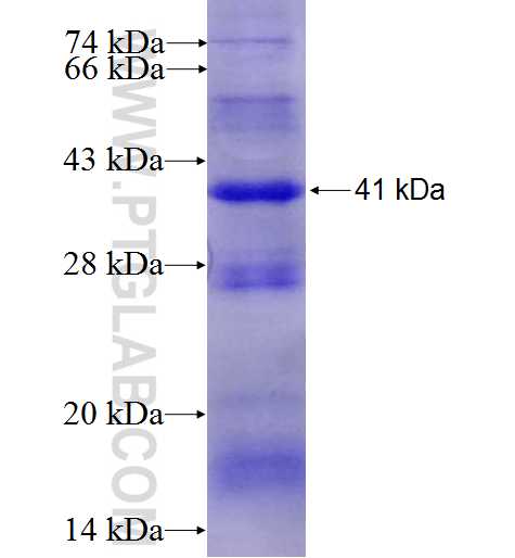 SCNN1G fusion protein Ag5286 SDS-PAGE