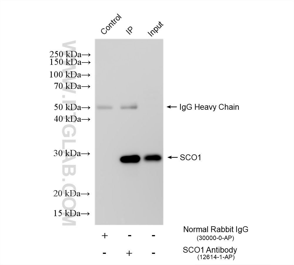 IP experiment of HepG2 using 12614-1-AP Immunoprecipitation (IP) experiment of HepG2 cells using SCO1 Polyclonal antibody (12614-1-AP)
