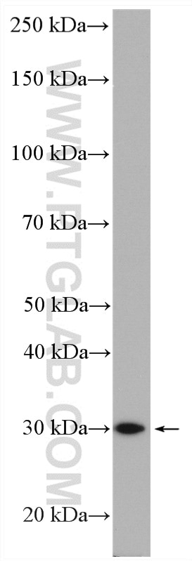 Western Blot (WB) analysis of LNCaP cells using SCO1 Polyclonal antibody (12614-1-AP)