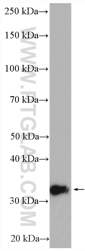 Western Blot (WB) analysis of human placenta tissue using SCO1 Polyclonal antibody (12614-1-AP)