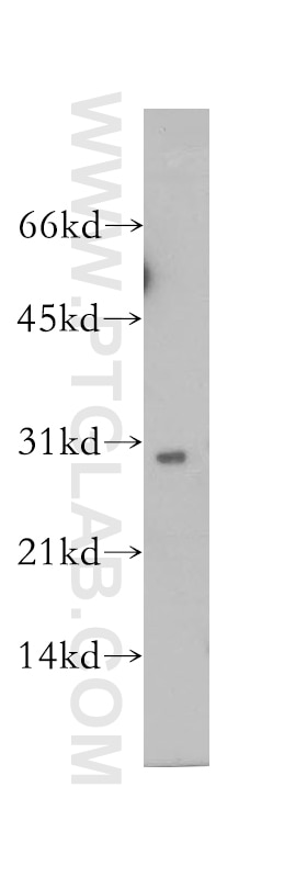 Western Blot (WB) analysis of human heart tissue using SCO1 Polyclonal antibody (12614-1-AP)