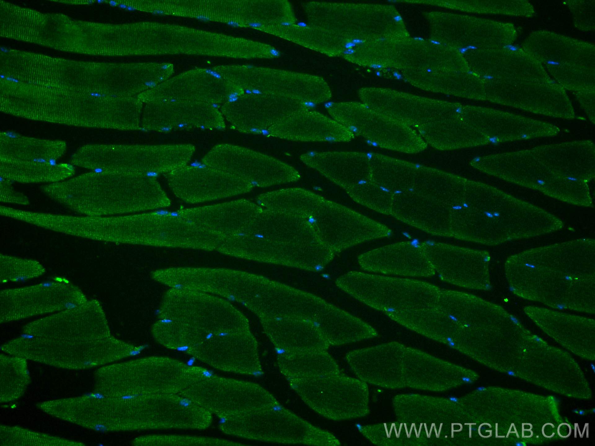 IF Staining of mouse skeletal muscle using 21223-1-AP