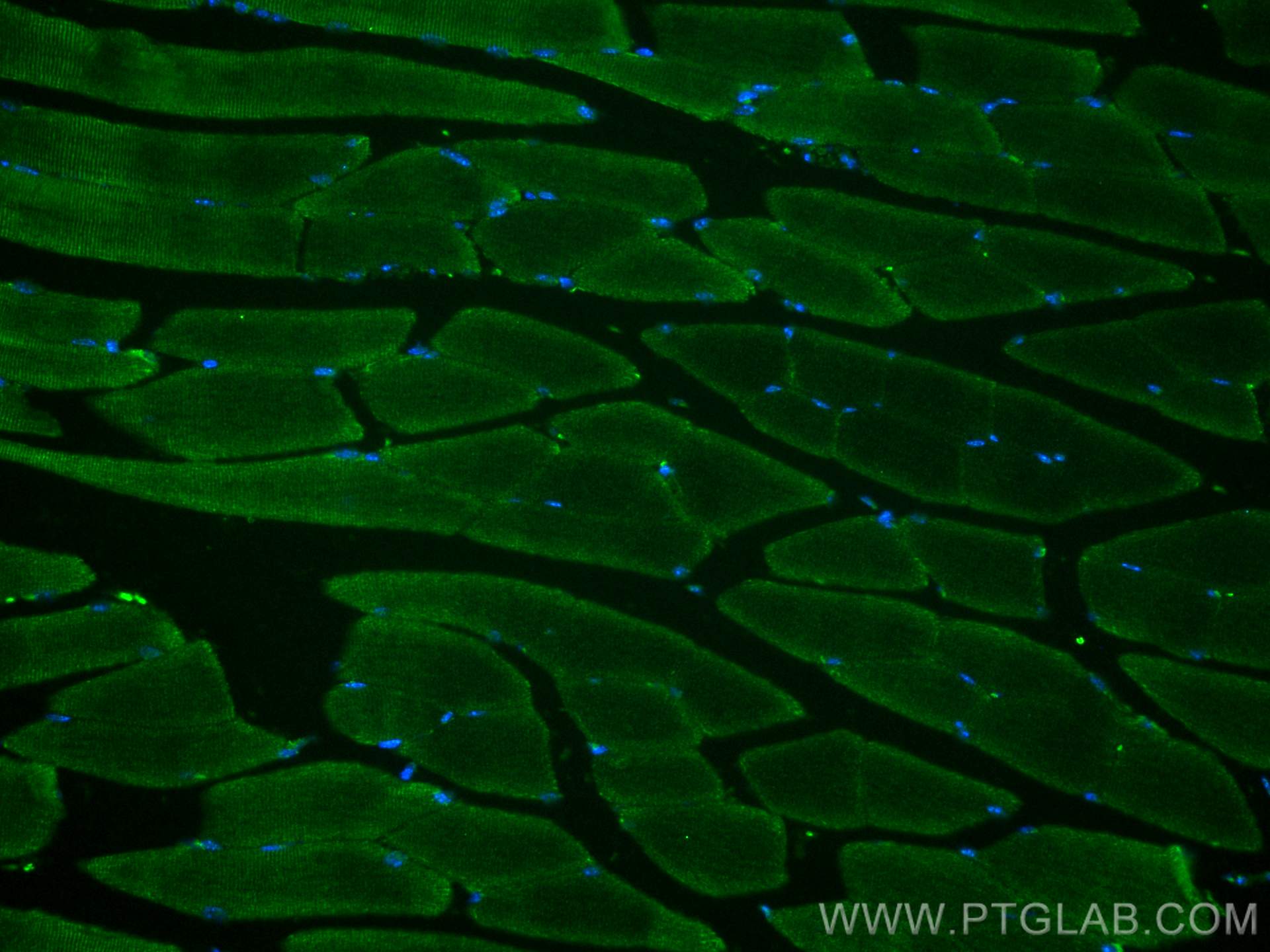 Immunofluorescence (IF) / fluorescent staining of mouse skeletal muscle tissue using SCO2 Polyclonal antibody (21223-1-AP)