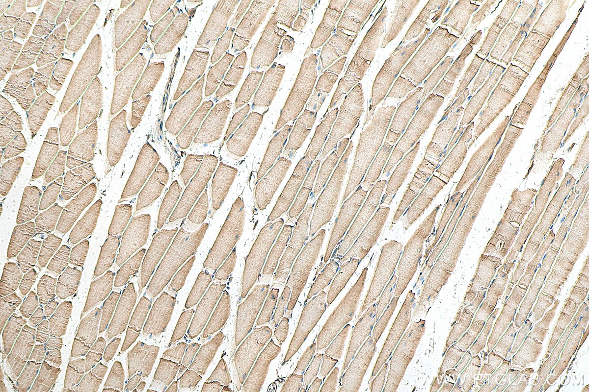 Immunohistochemistry (IHC) staining of mouse skeletal muscle tissue using SCO2 Polyclonal antibody (21223-1-AP)